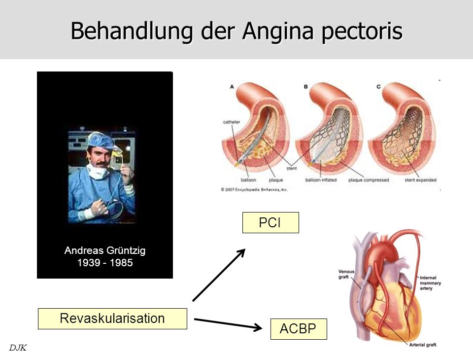 angina pectoris symptome dauer angina pectoris symptome dauer